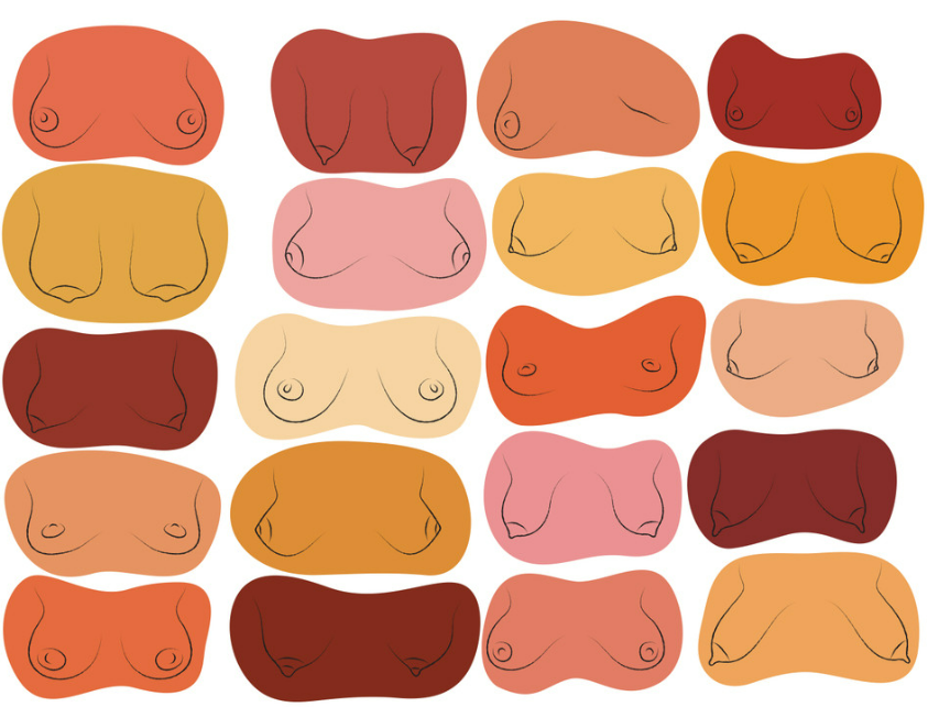Understanding the Different Breast Shapes